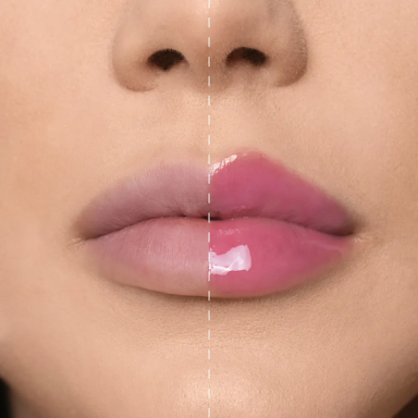Mesauda Lip Phenom PH Lip Plumper apimtį didinantis blizgesys-aliejus lūpoms